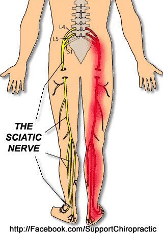 sciatic
